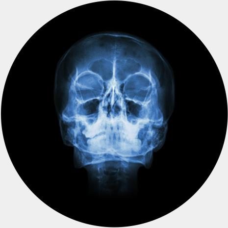 döskalle Halloween | Tårtbilder till Halloween | HobbyPyssel